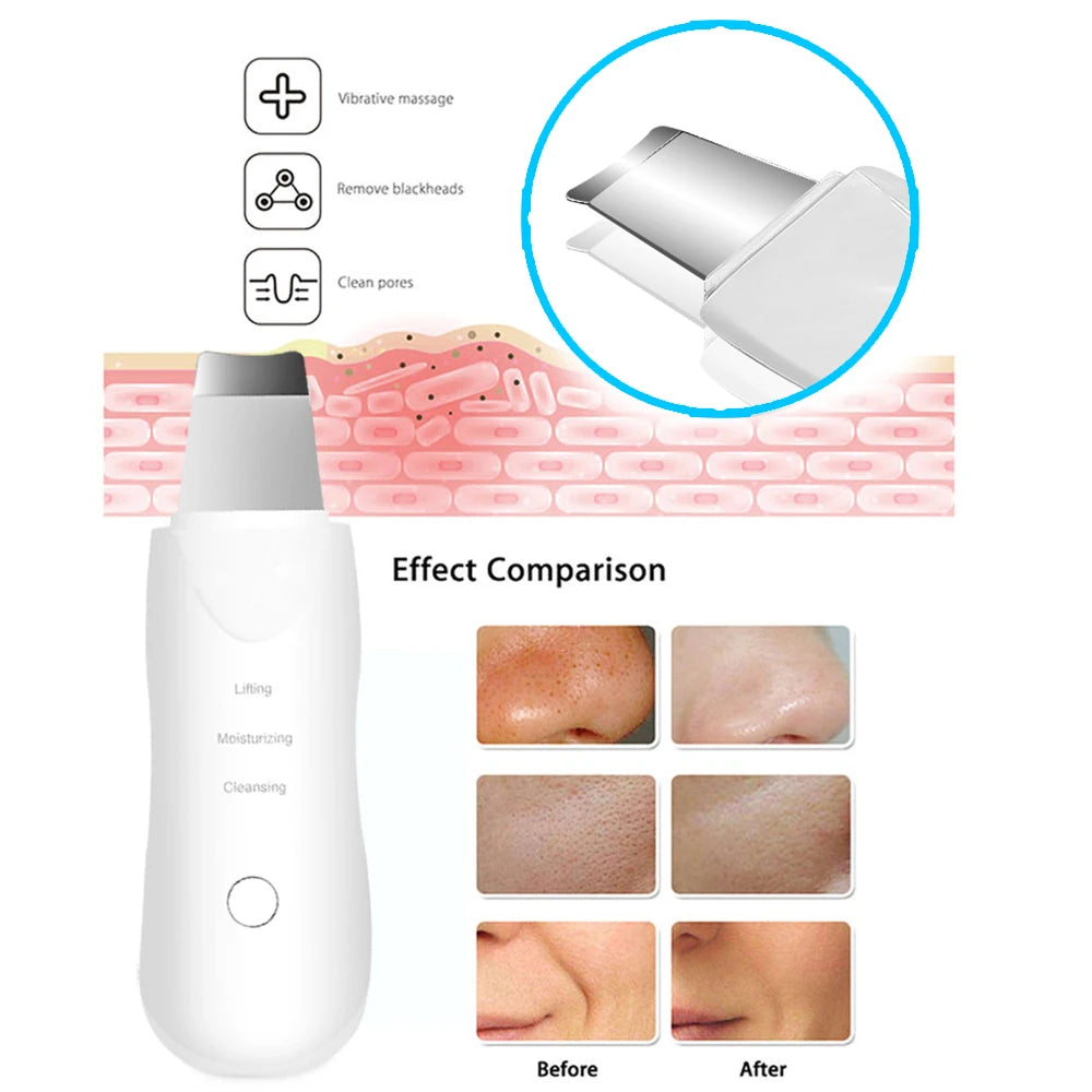 Anti Aging Ultrasonic Deep Facial Cleaner Vibrating Skin Scrubber Facial Massager Black Head Remover Personal Care Device