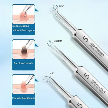 Acne Blackhead Remover Tools for Pimples Blackheads German Ultra Fine No. 5  Special Clip Tweezers Beauty Face Health Salon