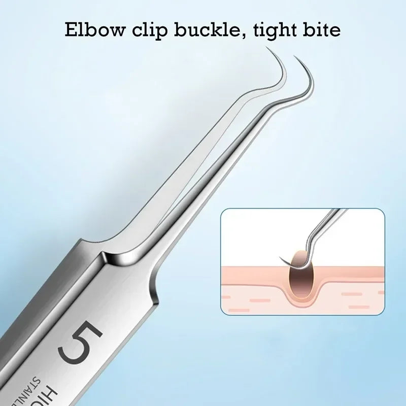 Acne Blackhead Remover Tools for Pimples Blackheads German Ultra Fine No. 5  Special Clip Tweezers Beauty Face Health Salon