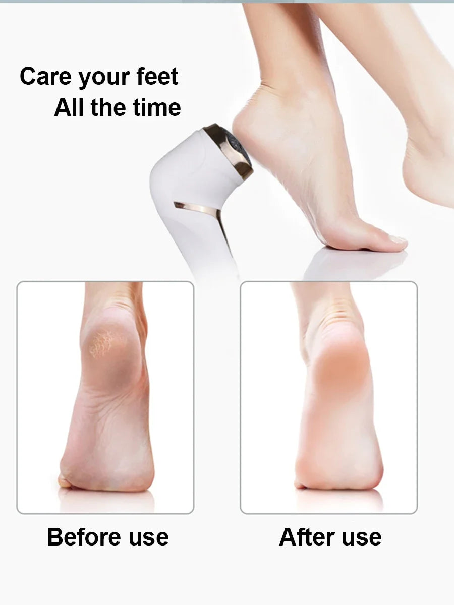 Rechargeable Electric Foot File Pedicure Machine Callus Remover Heal Cracked Feet Dead Skin Scrubber Grinder Tools