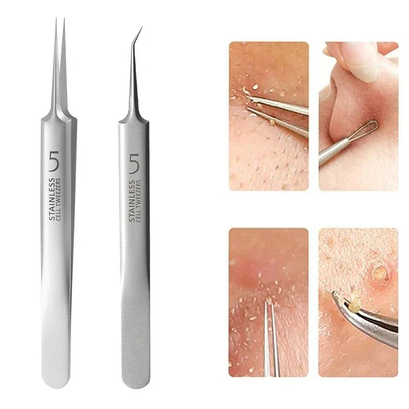 Acne Blackhead Remover Tools for Pimples Blackheads German Ultra Fine No. 5  Special Clip Tweezers Beauty Face Health Salon