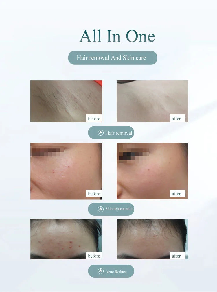 Whole Body Professional Permanent Hair Removal Laser Depilator IPL for Home Use Personal Care Device