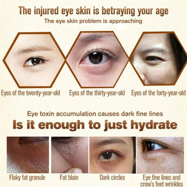 Firming Fat Granules Remover Eye Cream Improve Eye Bag Fade Fine Lines Moisturizing Anti-Puffiness Lifting Skin Care