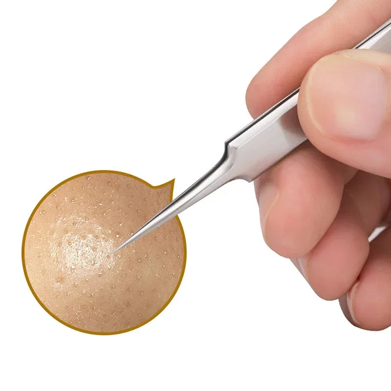 Acne Blackhead Remover Tools for Pimples Blackheads German Ultra Fine No. 5  Special Clip Tweezers Beauty Face Health Salon