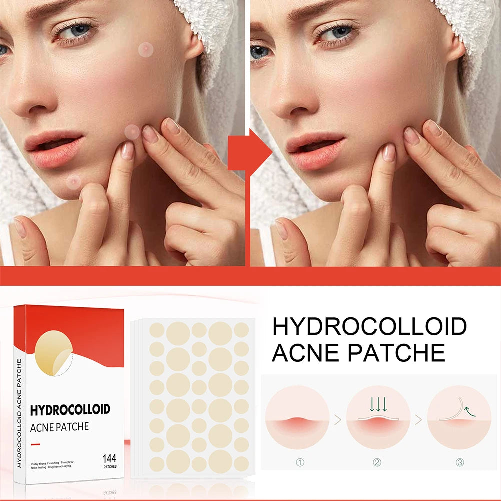 Acne Pimple Patches 144pcs Face Skin Care for Men and Women 2 Sizes Invisible Professional Healing Absorbing Spot Sticker Covering