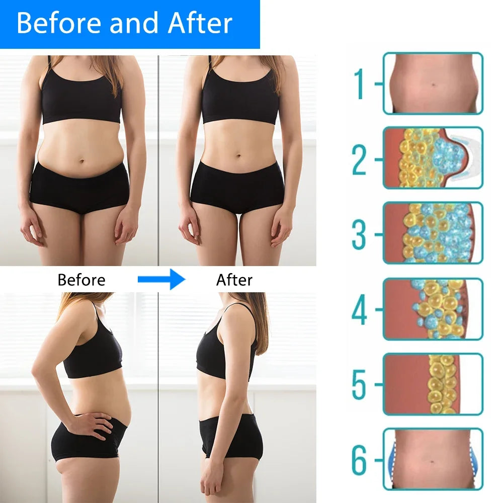 Anti Cellulite Cryotherapy Abdominal Cold Therapy Muscle Stimulator Massager Lipo Machine Dissolve Fat Body Slimming Criolipolisis
