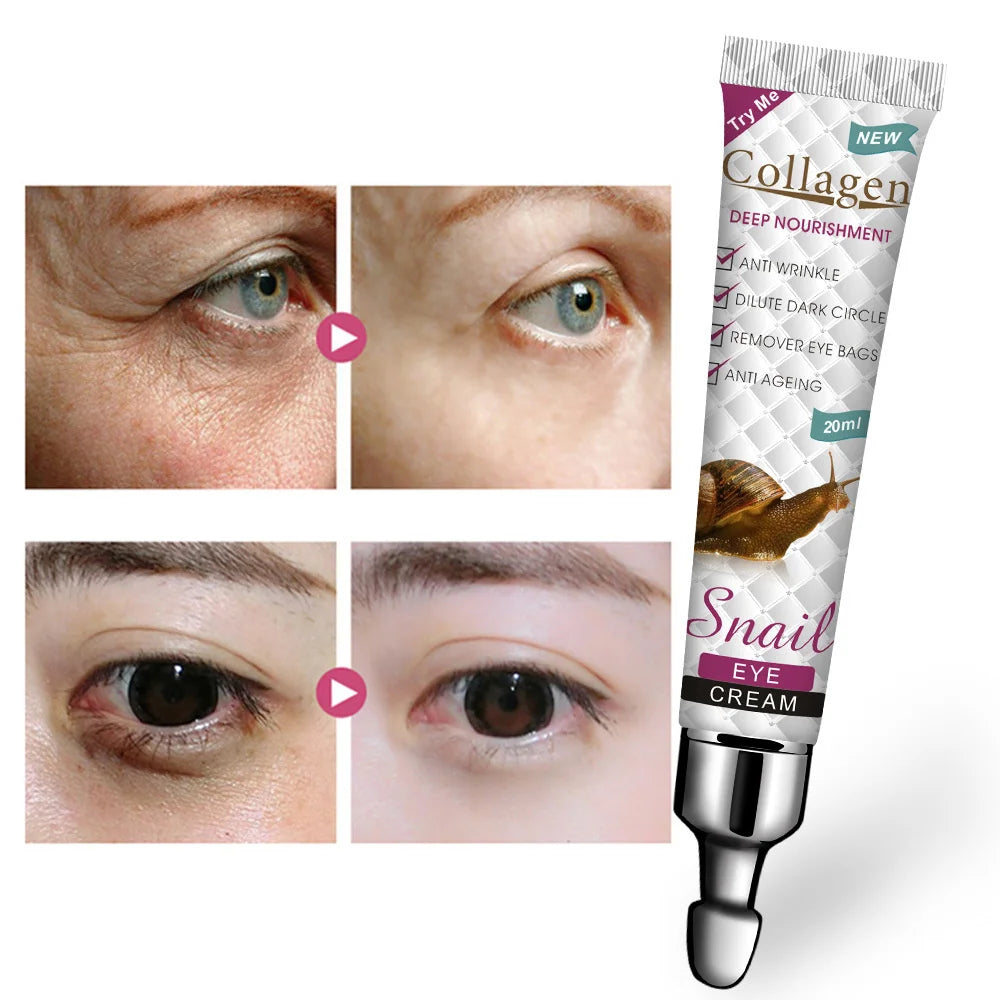 Firming Fat Granules Remover Eye Cream Improve Eye Bag Fade Fine Lines Moisturizing Anti-Puffiness Lifting Skin Care