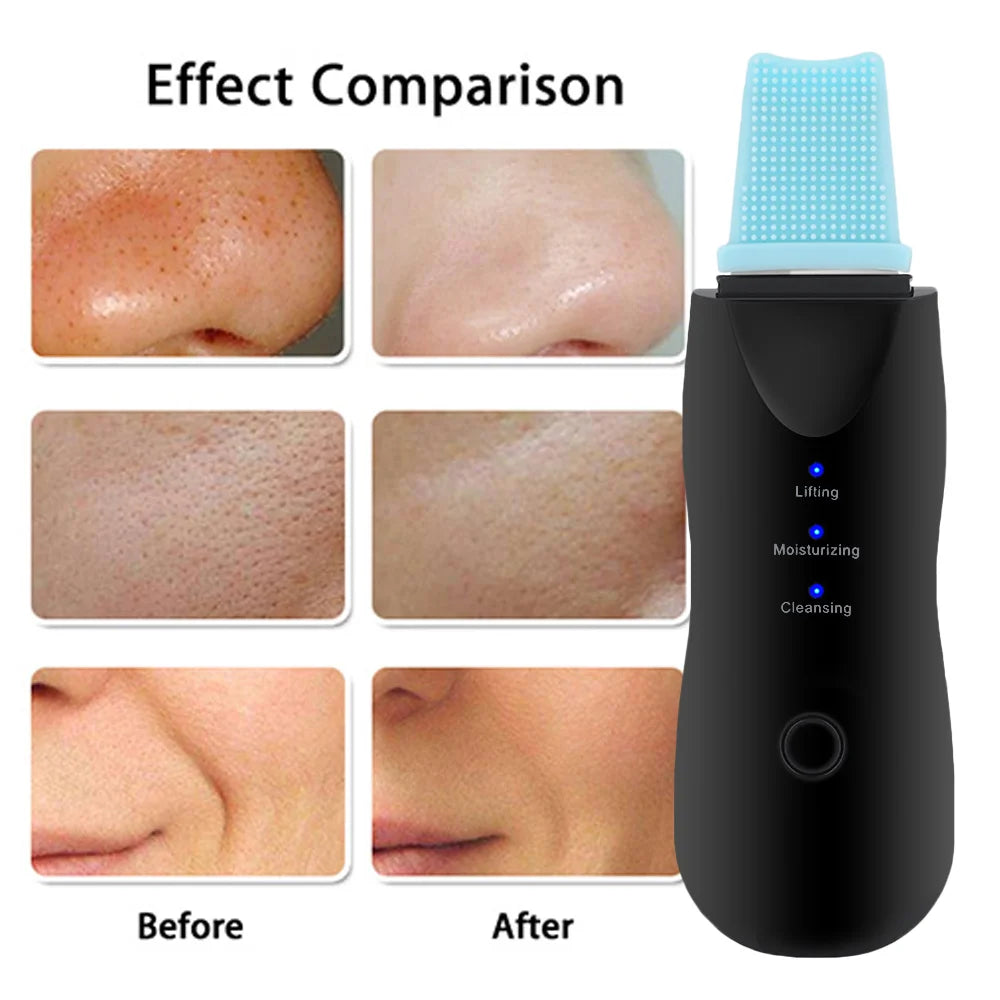 Ultrasonic Electric Facial Cleaning and Massaging Kit with Skin Scrubber, Blackhead Remover Pore Cleaner, Nano Face Steamer, Facial Massager and Eye Beauty Pen