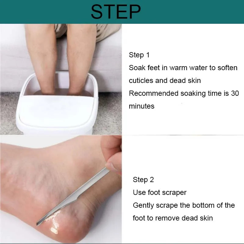 Manicure and Pedicure Foot Callus Scraper Rasp File Tool Pedicure Dead Skin Remover Foot Care Tools