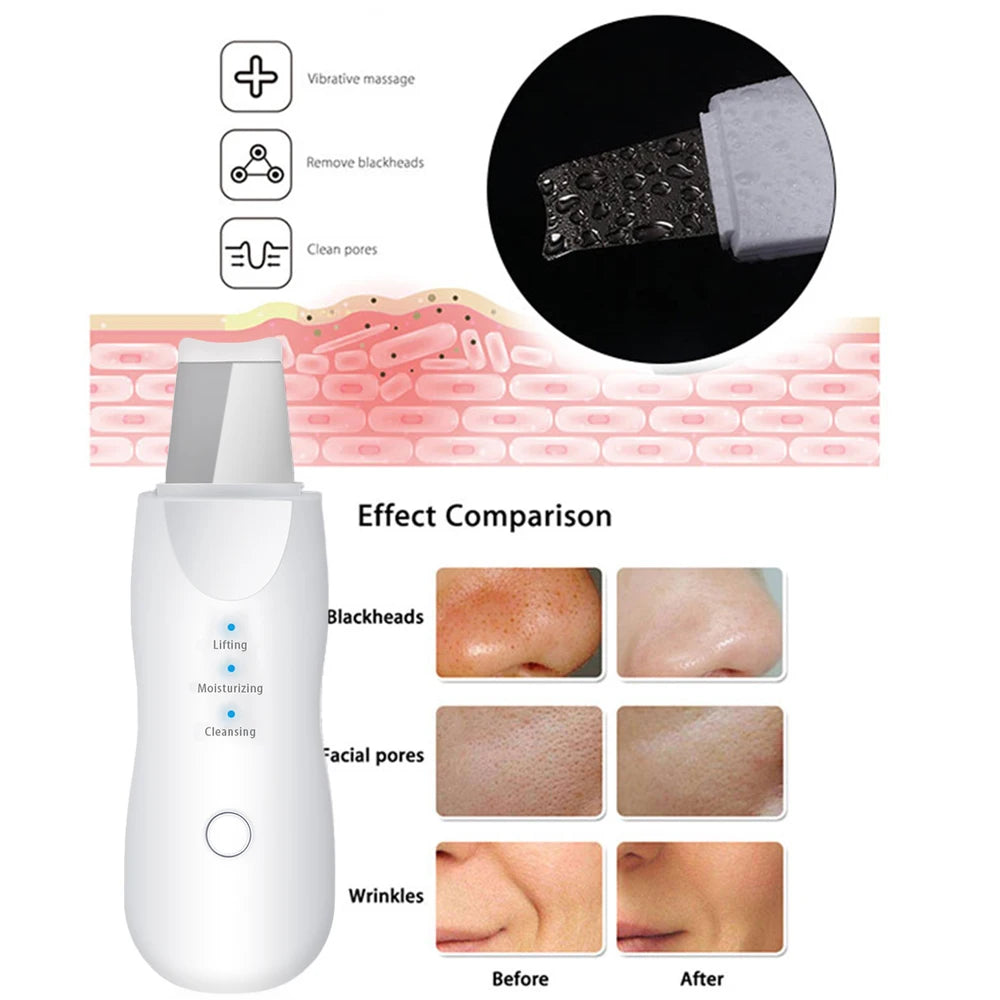 Ultrasonic Electric Facial Cleaning and Massaging Kit with Skin Scrubber, Blackhead Remover Pore Cleaner, Nano Face Steamer, Facial Massager and Eye Beauty Pen