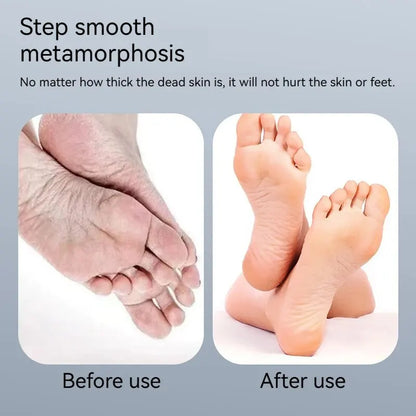 Automatic Electric Pedicure and Foot Peeling Tool Callus Grinding and Sanding Machine