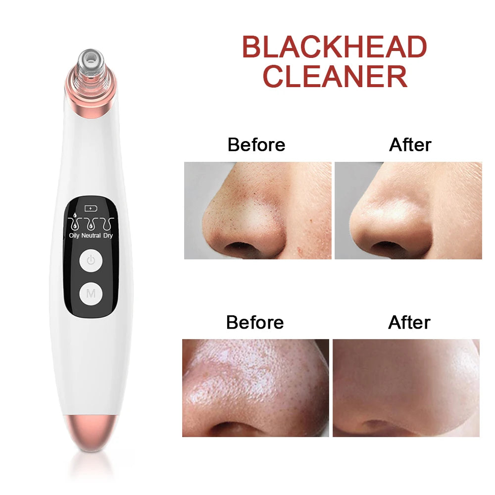 Ultrasonic Electric Facial Cleaning and Massaging Kit with Skin Scrubber, Blackhead Remover Pore Cleaner, Nano Face Steamer, Facial Massager and Eye Beauty Pen
