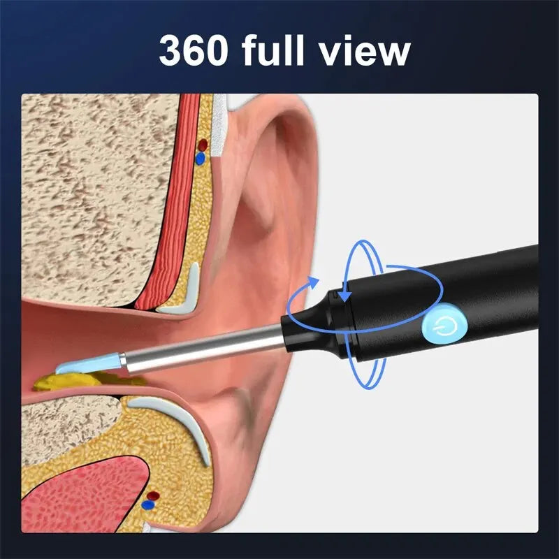 Wonderful Ear Cleaner Wax Remover with Camera Endoscope for iPhone iPad Android Ear Stick Silicone Spoon Personal Health Care Tools