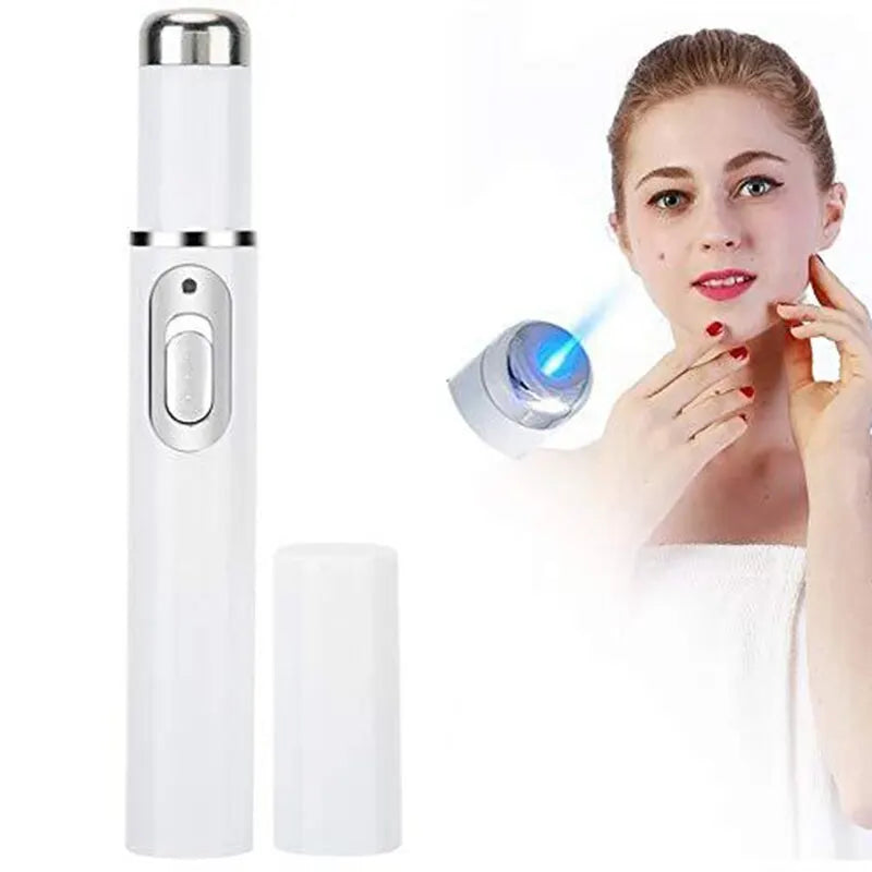 Blue Light Electronic Facial Beauty Eye Massager Reduce Eye Circles and Eye Bags Face Care Tool