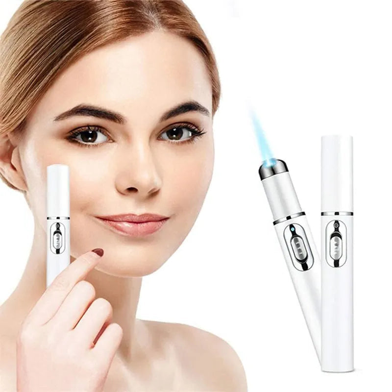 Blue Light Electronic Facial Beauty Eye Massager Reduce Eye Circles and Eye Bags Face Care Tool
